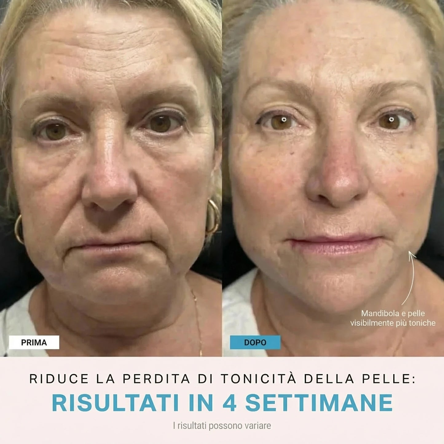 Facelia® | Dispositivo rassodante viso + 1 Siero in OMAGGIO