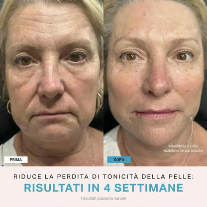 Facelia® | Dispositivo rassodante viso + 1 Siero in OMAGGIO