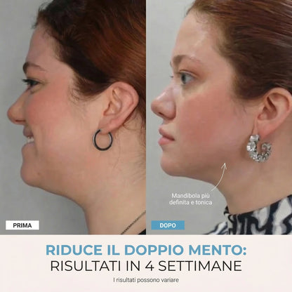 Facelia® | Dispositivo rassodante viso + 1 Siero in OMAGGIO