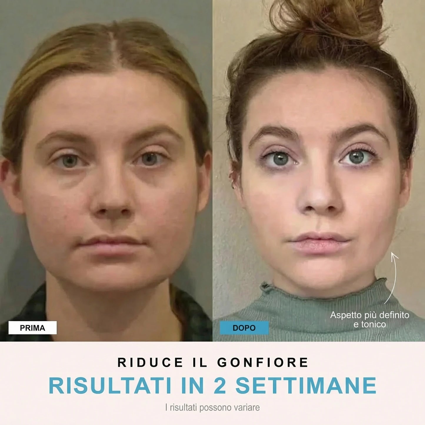Facelia® | Dispositivo rassodante viso + 1 Siero in OMAGGIO