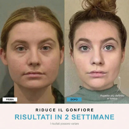 Facelia® | Dispositivo rassodante viso + 1 Siero in OMAGGIO