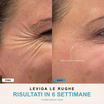 Facelia® | Dispositivo rassodante viso + 1 Siero in OMAGGIO
